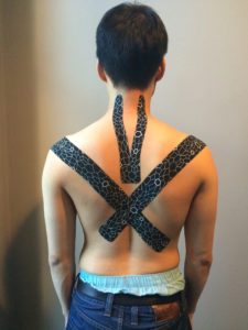 kinesiology tape for posture